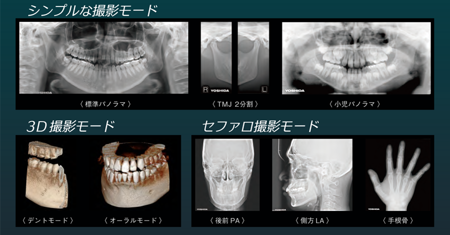 CTレントゲン　アルト歯科・奏の杜