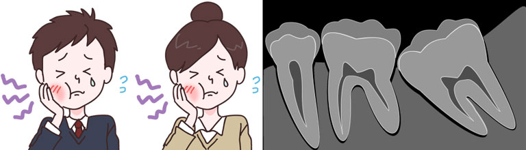口臭、虫歯、歯周病、顔が歪む原因になります