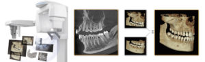 　X-ERA SMART CTレントゲン　アルト歯科　奏の杜